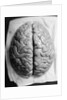 The Human Brain by Anonymous