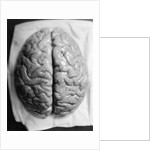 The Human Brain by Anonymous