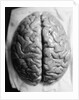 The Human Brain by Anonymous