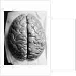 The Human Brain by Anonymous