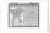 An advertisement for Dr. Scott's electrical corset by Anonymous