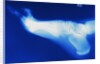 X-Ray of Person's Foot by Anonymous