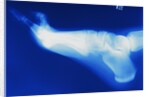 X-Ray of Person's Foot by Anonymous