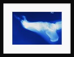 X-Ray of Person's Foot by Anonymous