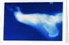 X-Ray of Person's Foot by Anonymous