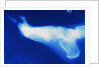 X-Ray of Person's Foot by Anonymous