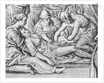 Patient Having Caesarian Performed by Anonymous