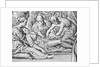 Patient Having Caesarian Performed by Anonymous