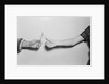 Breaking a Wishbone by Anonymous