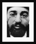 Face of French Artist Henri de Toulouse-Lautrec by Anonymous