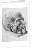 Illustration of Dissected Head by Anonymous