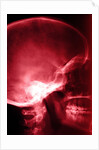 X-Ray of Human Skull by Corbis