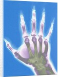 X-ray of a Hand by Anonymous