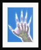 X-ray of a Hand by Anonymous