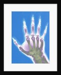 X-ray of a Hand by Anonymous