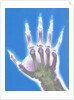 X-ray of a Hand by Anonymous