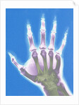 X-ray of a Hand by Anonymous