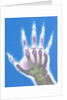 X-ray of a Hand by Anonymous