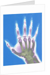 X-ray of a Hand by Anonymous