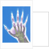 X-ray of a Hand by Anonymous