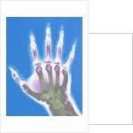 X-ray of a Hand by Anonymous