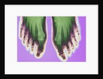 X-ray of Feet by Anonymous
