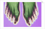 X-ray of Feet by Anonymous