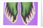 X-ray of Feet by Anonymous