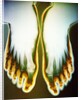X-ray of Feet by Anonymous