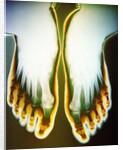 X-ray of Feet by Anonymous