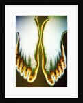X-ray of Feet by Anonymous