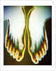 X-ray of Feet by Anonymous