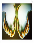 X-ray of Feet by Anonymous