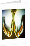 X-ray of Feet by Anonymous