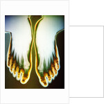 X-ray of Feet by Anonymous