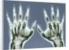 X-ray of Hands by Anonymous