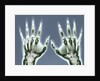 X-ray of Hands by Anonymous