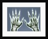 X-ray of Hands by Corbis