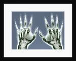 X-ray of Hands by Anonymous