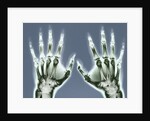 X-ray of Hands by Corbis