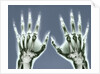 X-ray of Hands by Anonymous