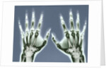 X-ray of Hands by Anonymous