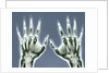 X-ray of Hands by Anonymous