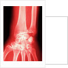 X-ray of a Wrist by Anonymous