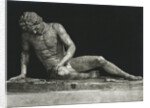 Sculpture of Man Partially Overcome by Anonymous