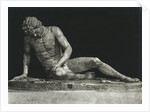 Sculpture of Man Partially Overcome by Anonymous