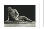 Sculpture of Man Partially Overcome by Anonymous