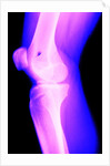 X-Ray of a Knee by Anonymous