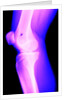 X-Ray of a Knee by Anonymous