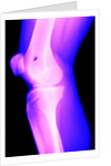 X-Ray of a Knee by Anonymous